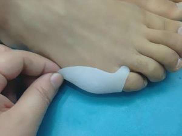 Ортез на палец стопы